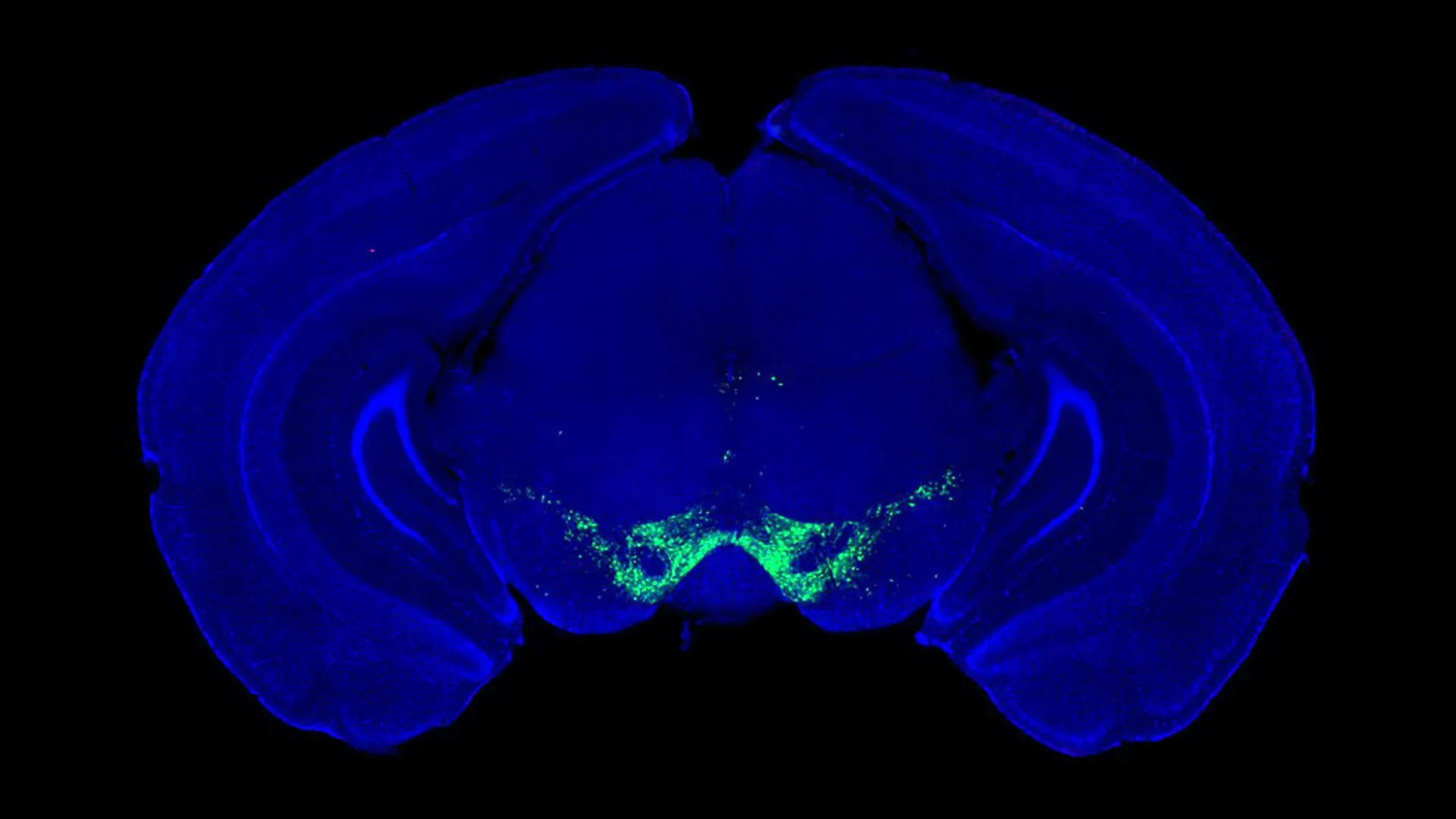 Avanço no Parkinson: Mudanças na Nossa Compreensão sobre a Dopamina