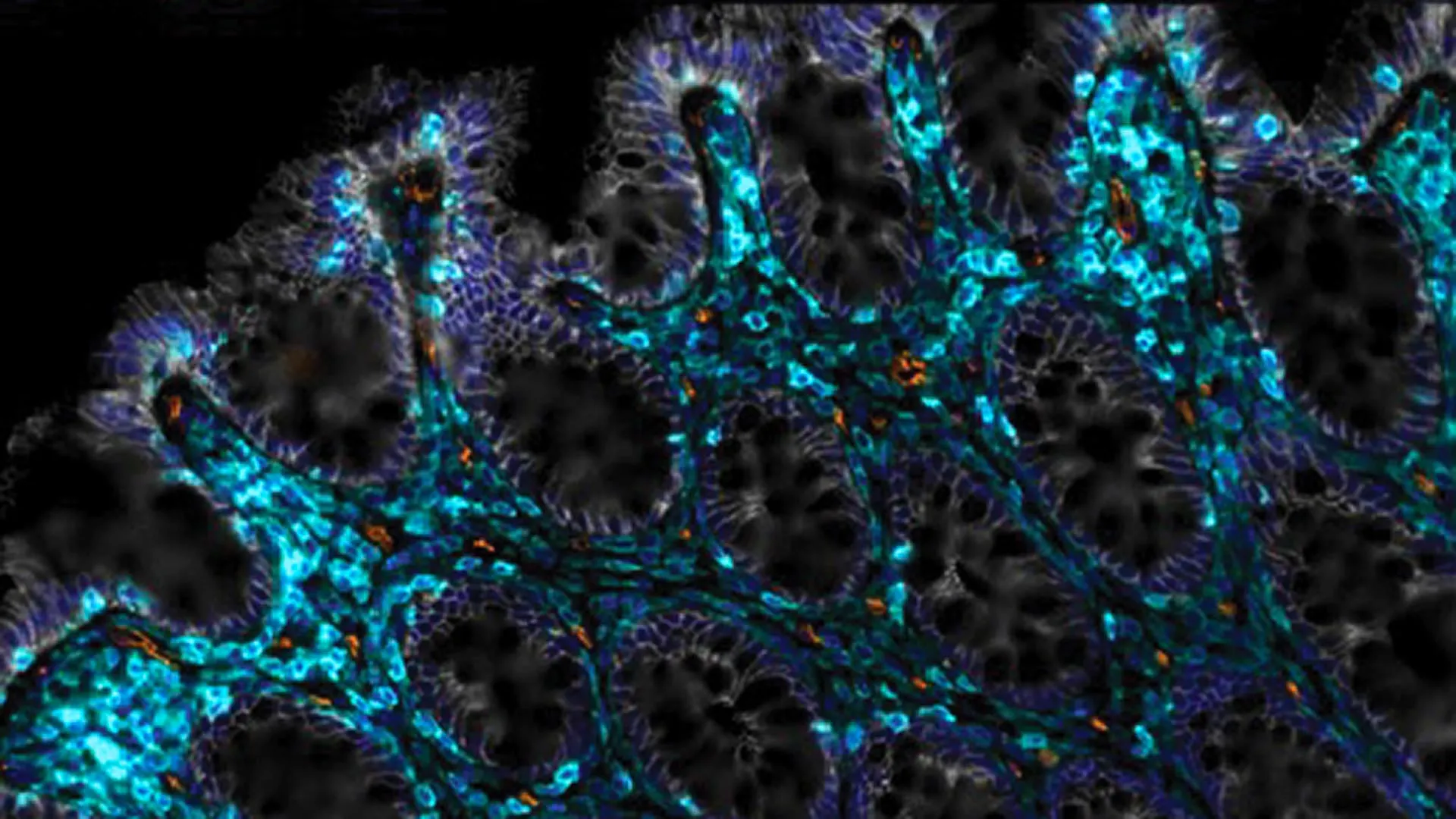 Cientistas encontram uma maneira de ajudar intestinos envelhecidos a se auto