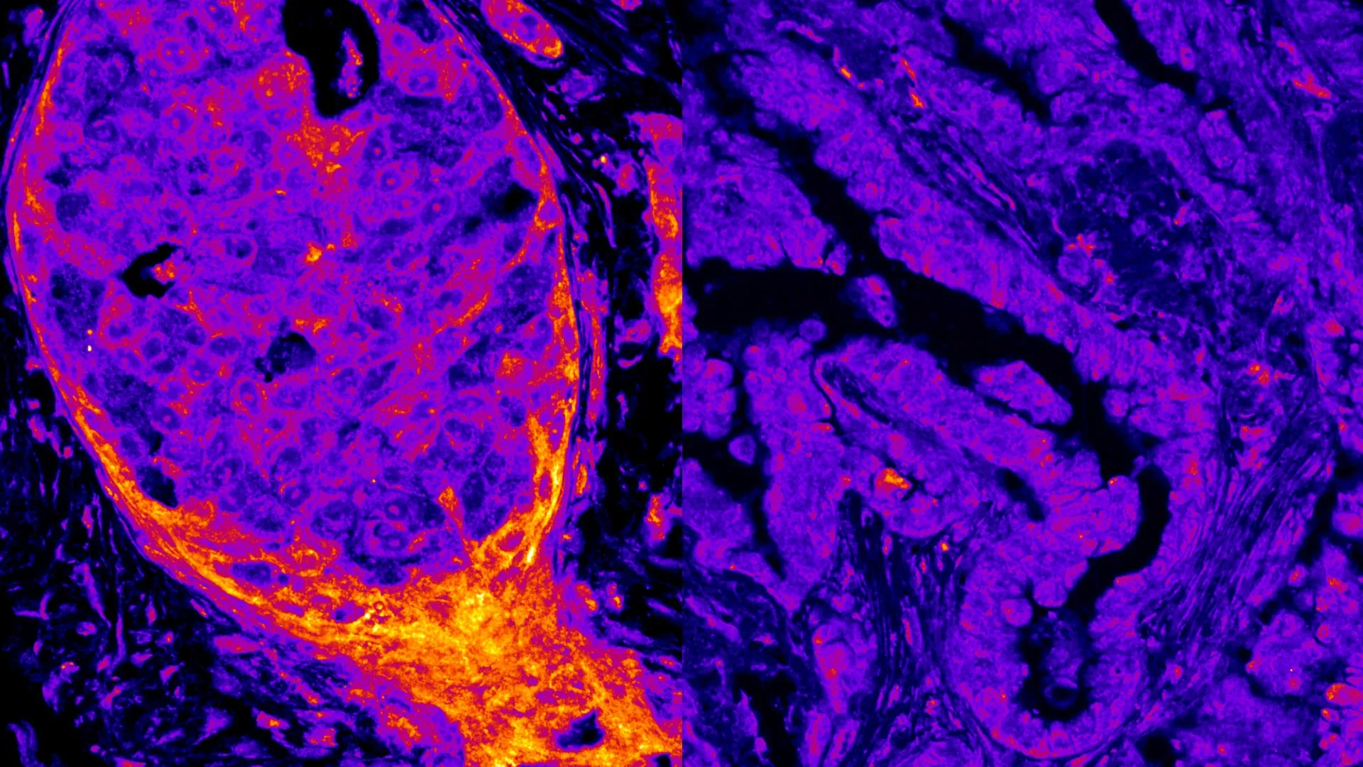 O Metabolismo Oculto Dentro do Núcleo Celular