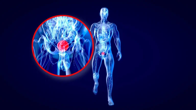 Imported Article – 2026-03-22 05:15:12