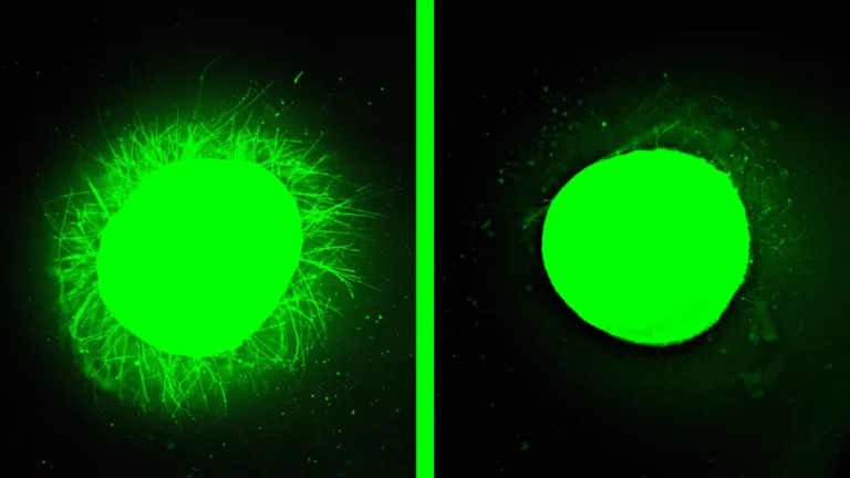 Corda Espinhal Humana Crescida em Laboratório Se Regenera Após Lesão em Avanço Revolucionário