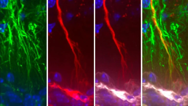 Cientistas descobrem células cerebrais ocultas que podem impedir o acúmulo de tau na doença de Alzheimer