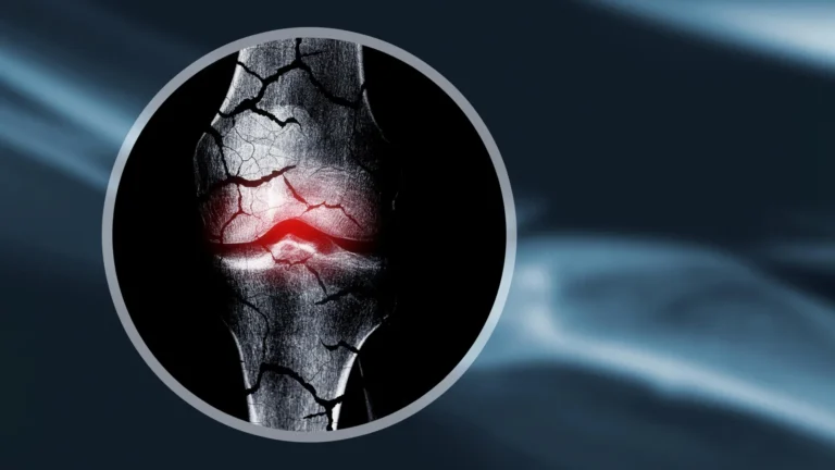 Cientistas criam estrutura de cartilagem que ajuda o corpo a regenerar os ossos