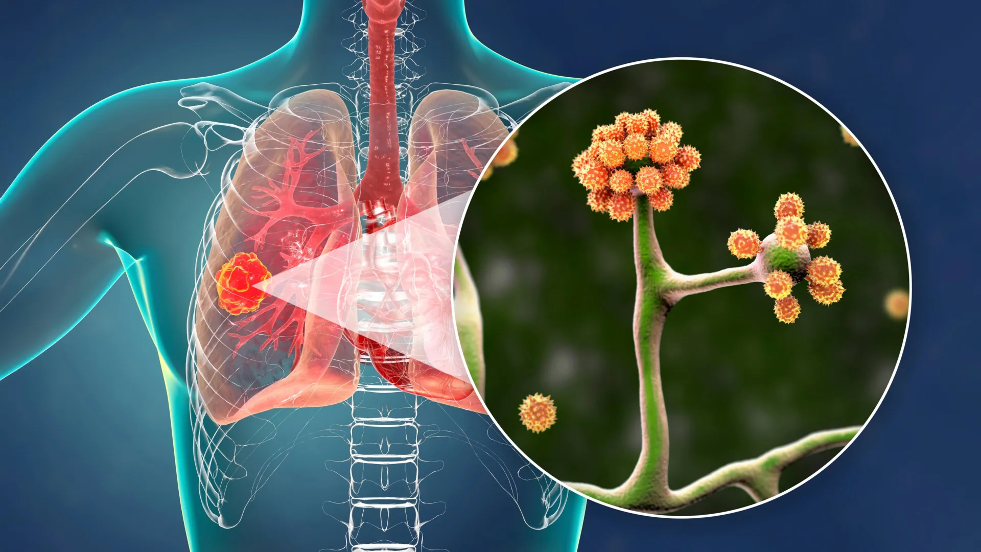 Esta proteína sanguínea simples pode combater um fungo negro mortal