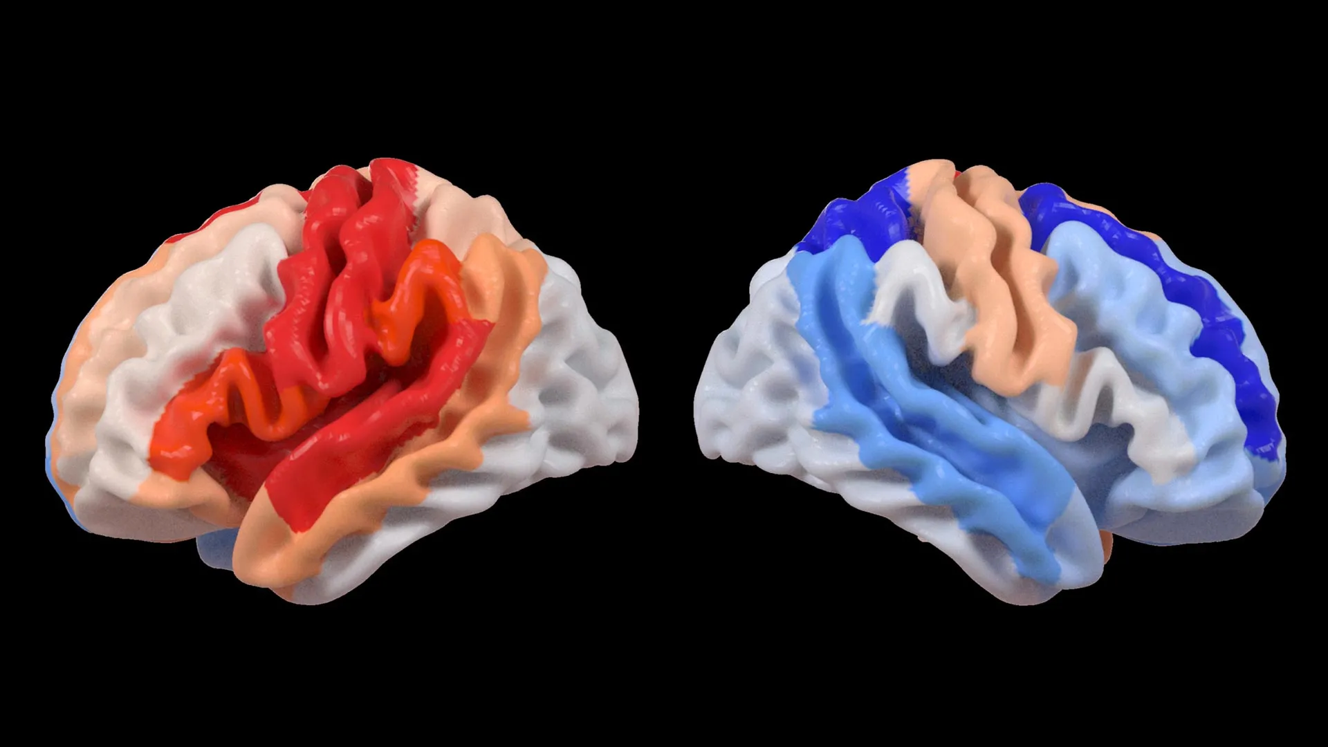 Um AVC desencadeia uma mudança cerebral oculta que se assemelha a rejuvenescimento