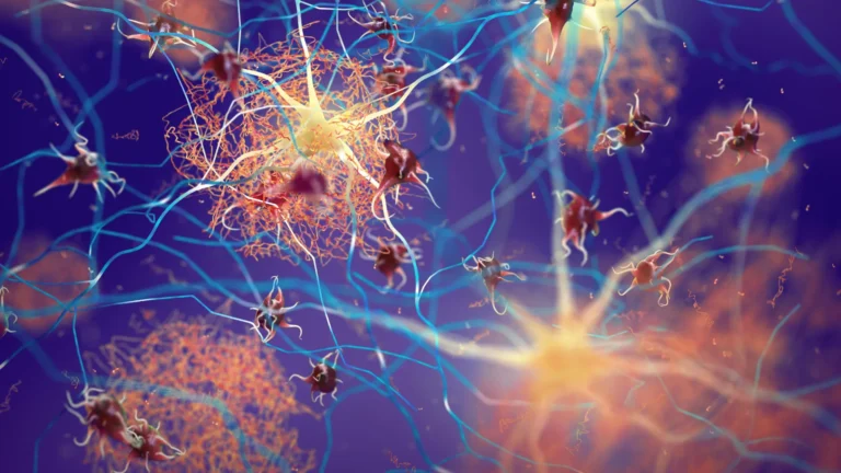 Uma proteína impulsionadora ajuda o cérebro a combater o Alzheimer