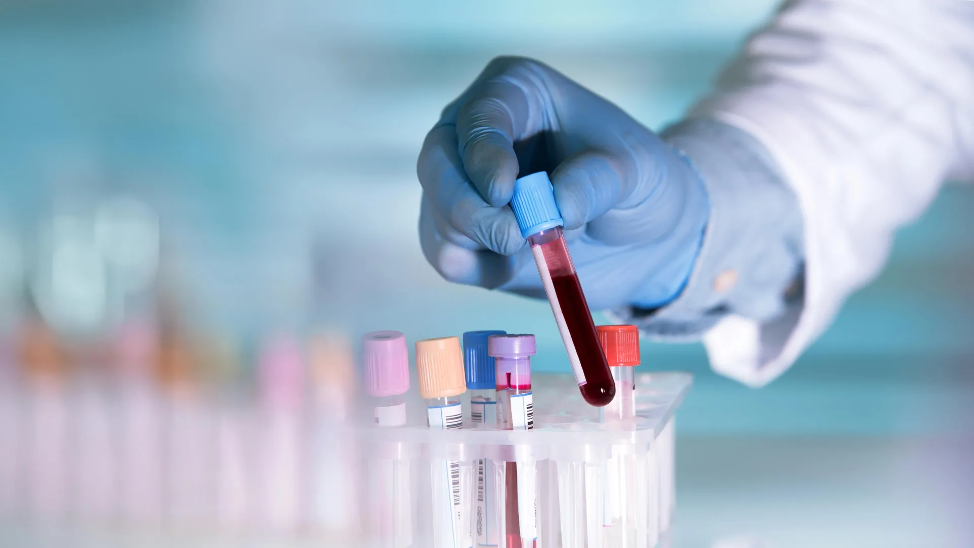 Este simples exame de sangue pode detectar a depressão antes de os sintomas aparecerem