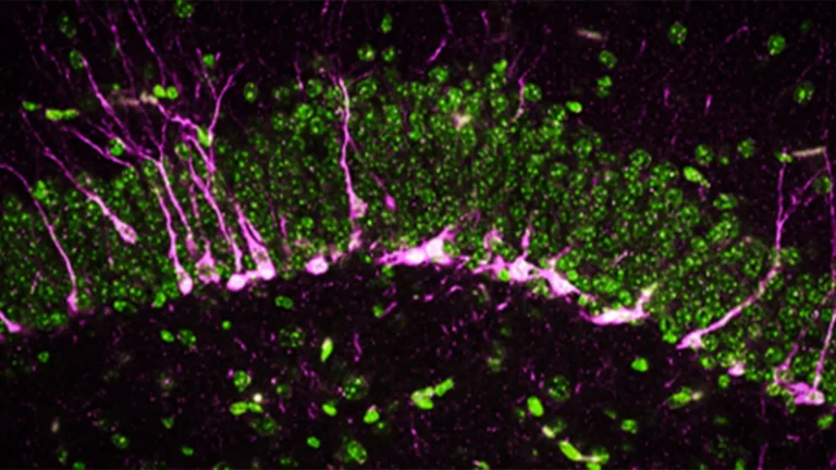 "Este gás cerebral com cheiro de ovo podre pode ser a chave para combater a doença de Alzheimer"