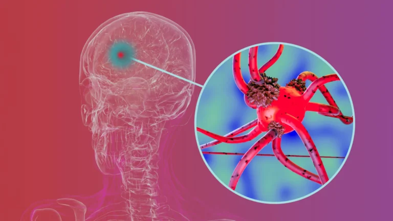 Proteína chave ajuda a disseminação do Parkinson pelo cérebro