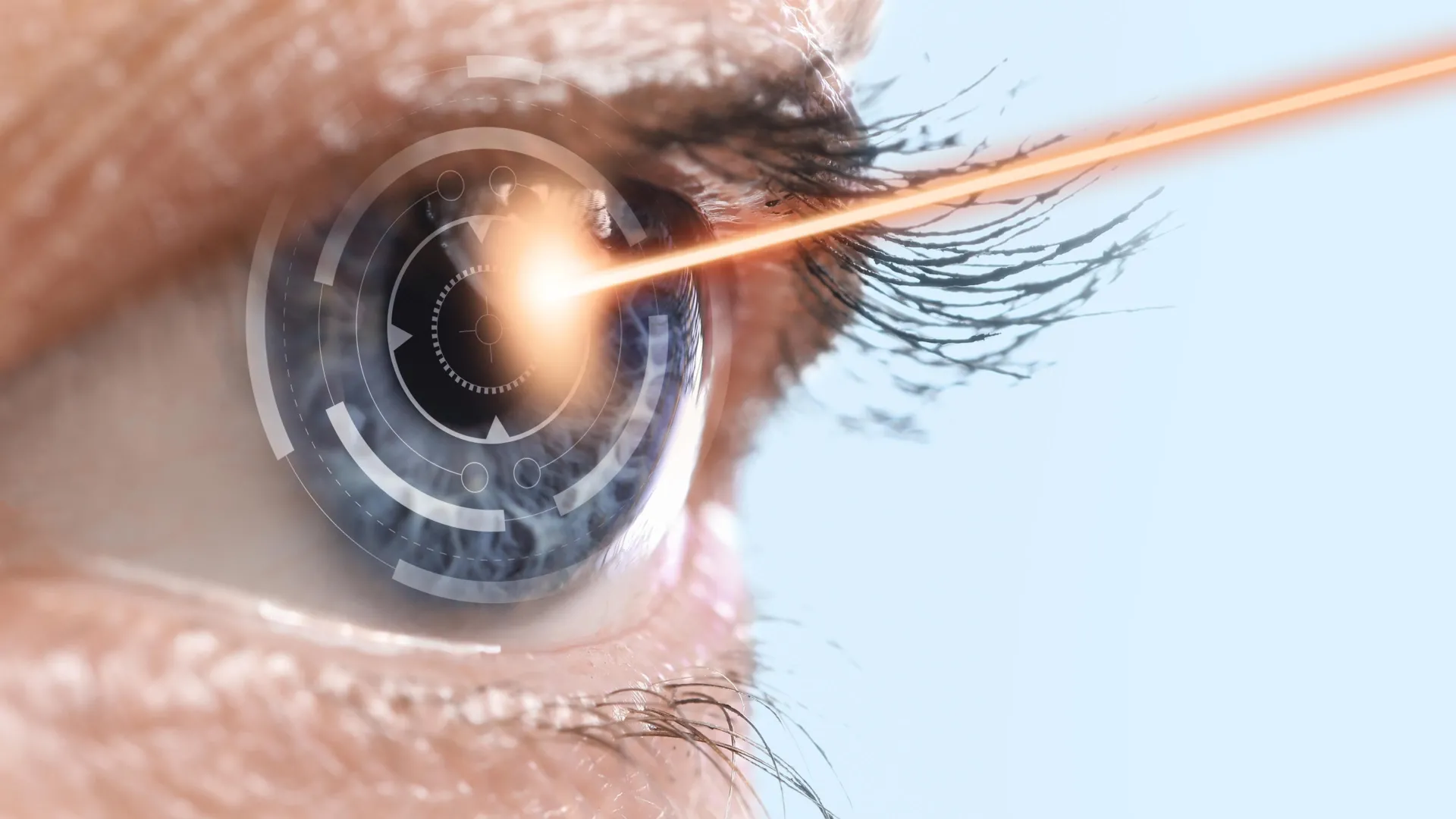 Novo tratamento a laser pode impedir a cegueira antes que comece