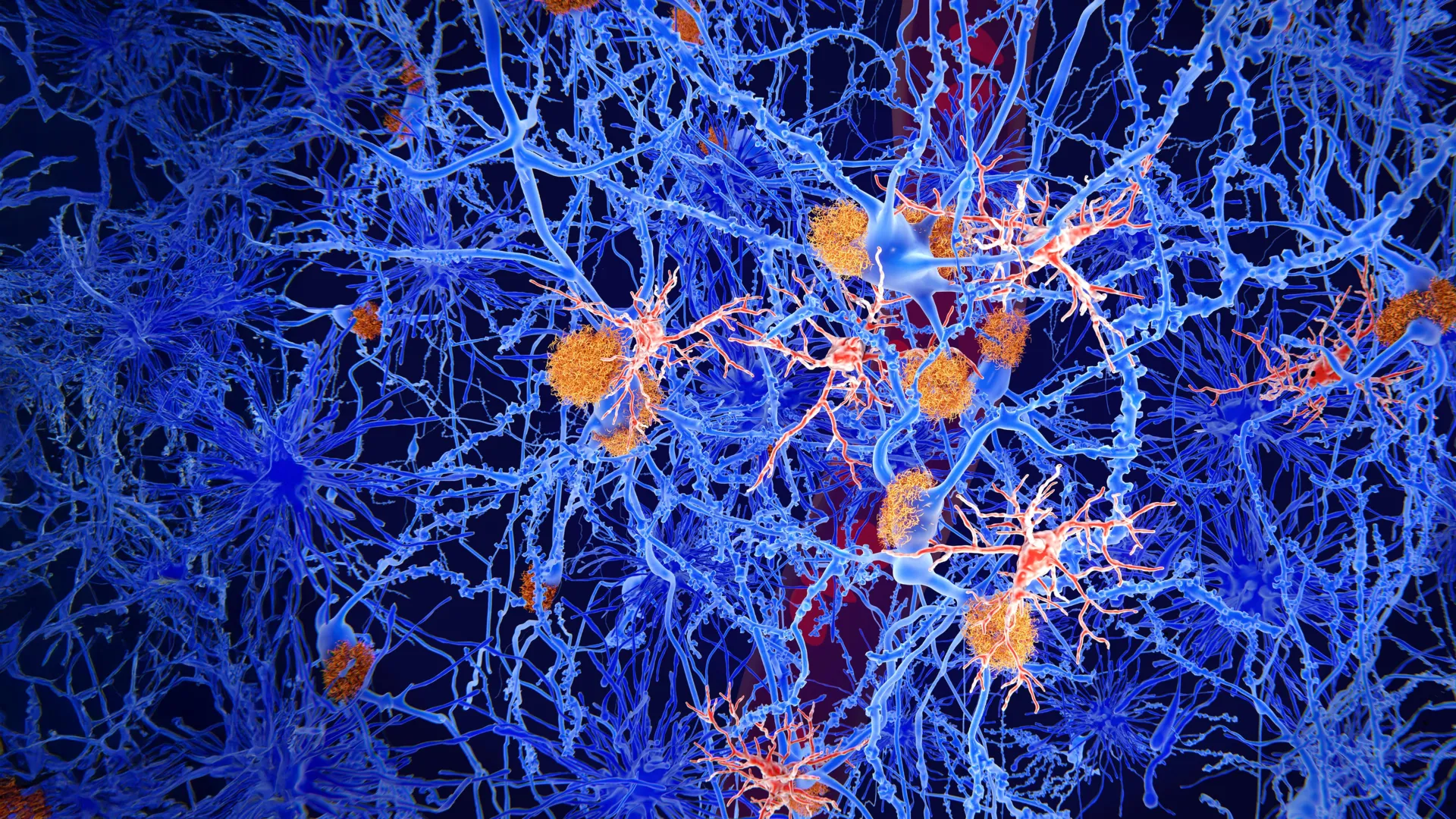 Cientistas reprogramam células imunes do cérebro para combater o Alzheimer